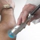 X-Trac Laser Excimer - traitement du psoriasis et du  Vitiligo